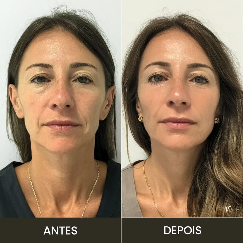 AGE Booster Pro: Dispositivo Coreano de Cuidado Facial