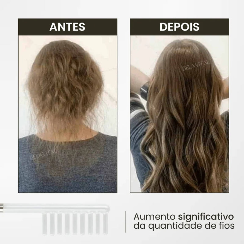 Kit Derma Capilar de Alta Frequência: Fios Fortes e Rosto Rejuvenescido
