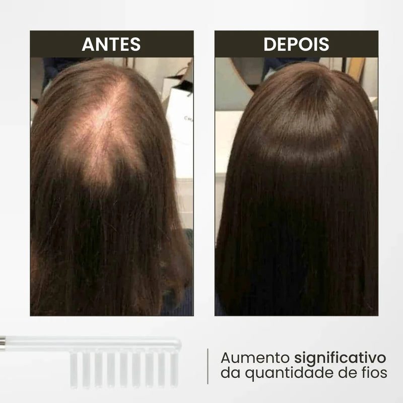 Kit Derma Capilar de Alta Frequência: Fios Fortes e Rosto Rejuvenescido