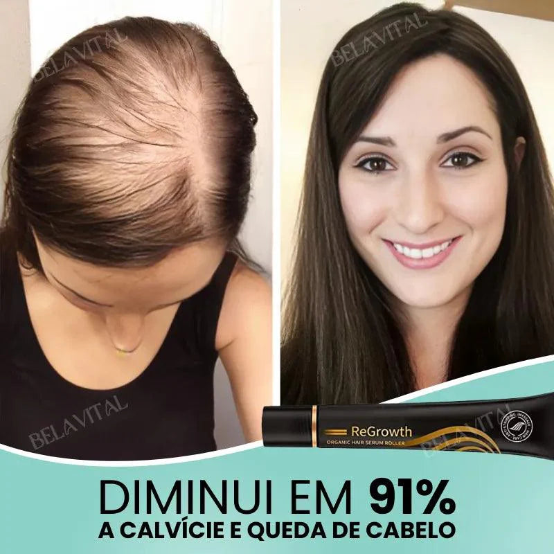 Repair Hair®: 95% Menos Queda 20x Mais Crescimento | Compre 1, Leve 2