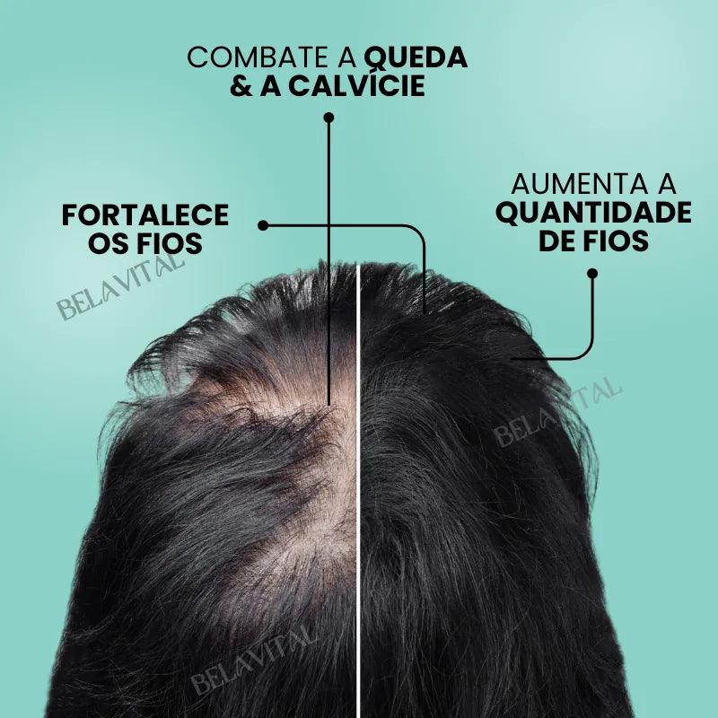Repair Hair®: 95% Menos Queda 20x Mais Crescimento | Compre 1, Leve 2